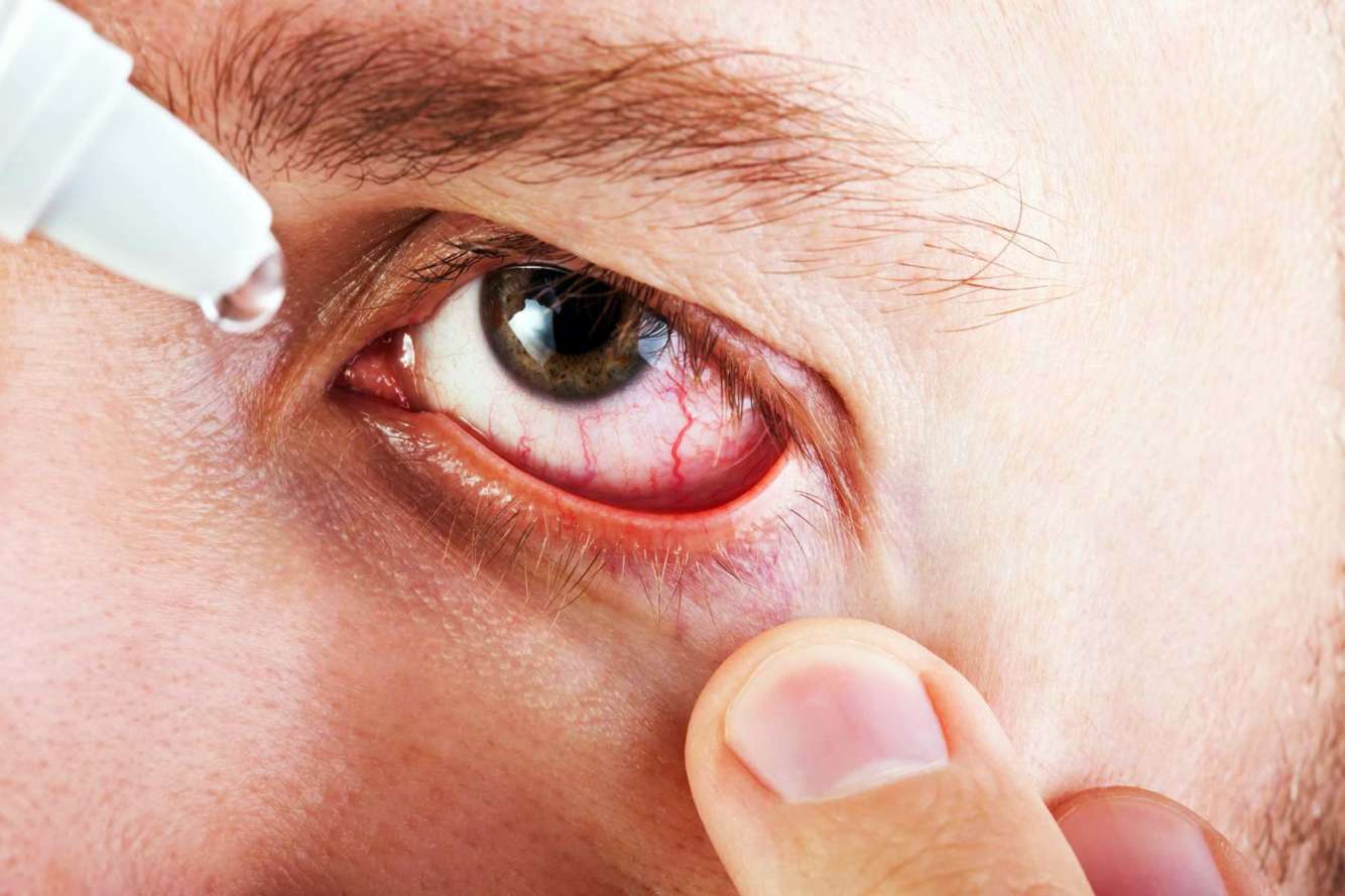 причины глазного давления у взрослых и лечение